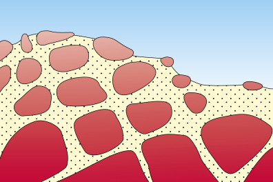 Formation d'un chaos granitique - étape 4
